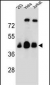 OR4C13 Antibody (N-term)